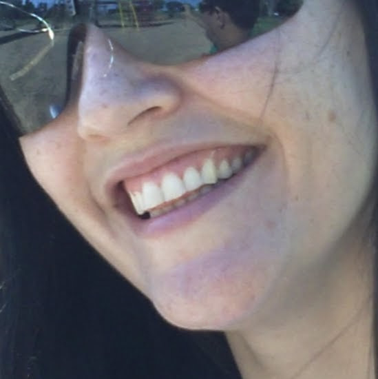 Auto Peças Carvalho